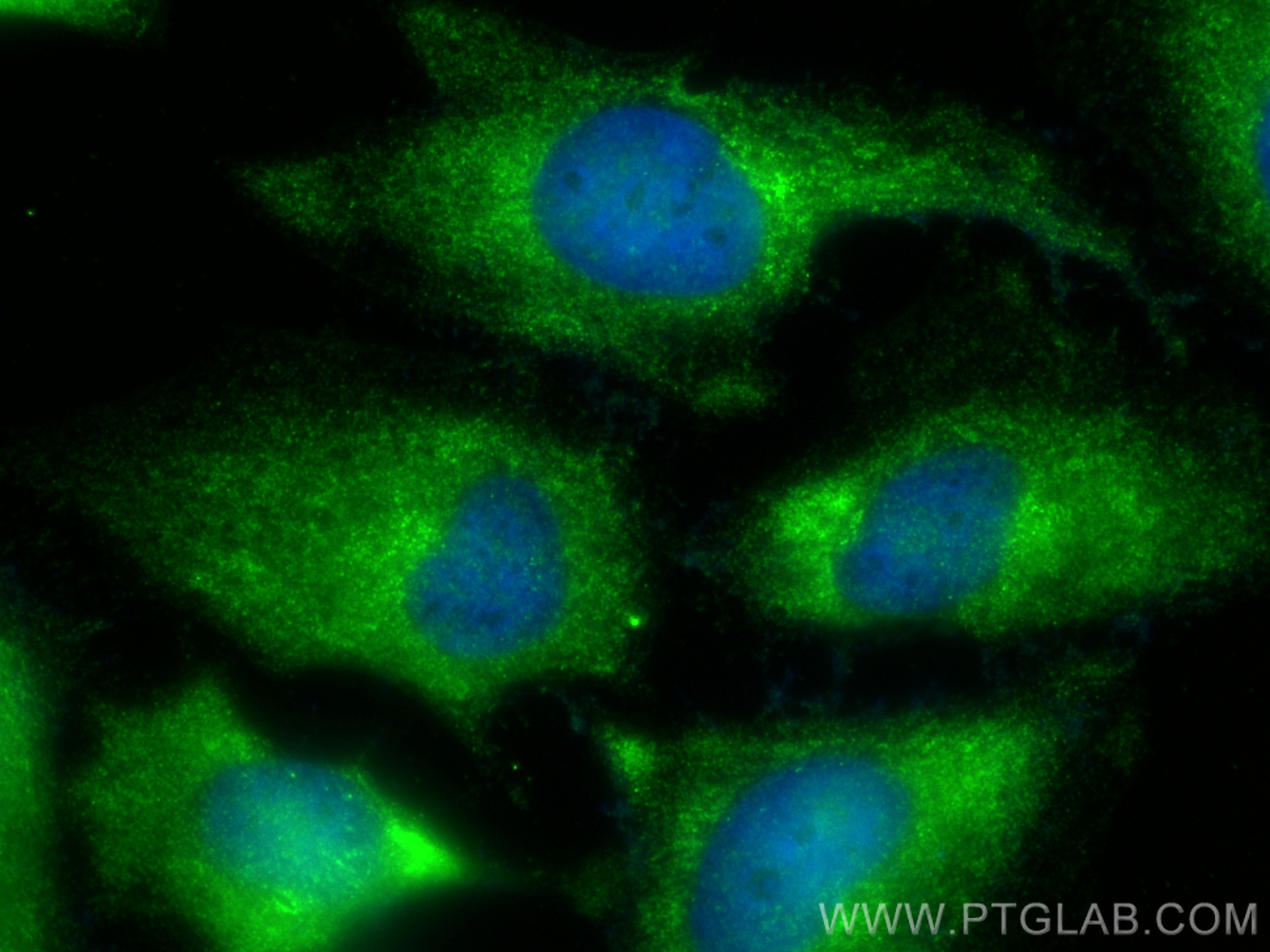 IF Staining of HeLa using 13411-1-AP