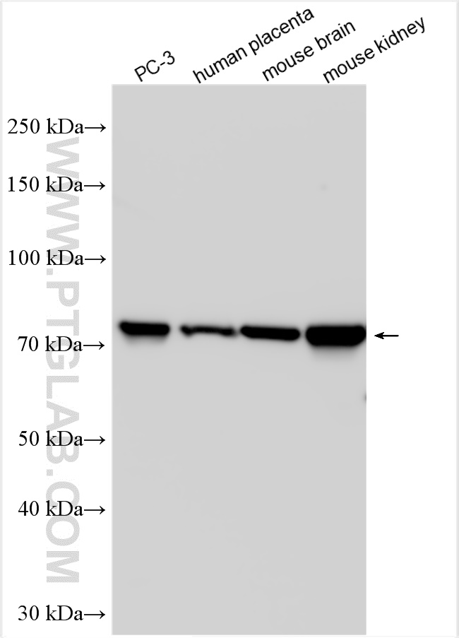 WB analysis using 31045-1-AP