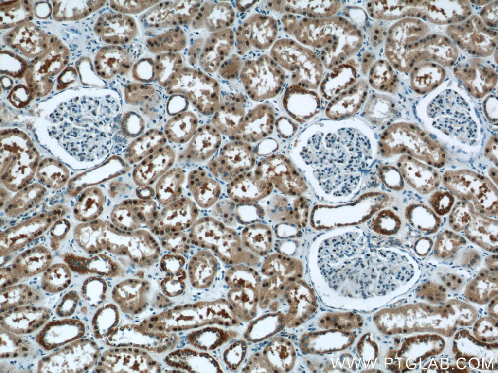 IHC staining of human kidney using 12520-1-AP