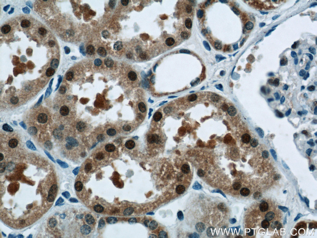 IHC staining of human kidney using 12520-1-AP