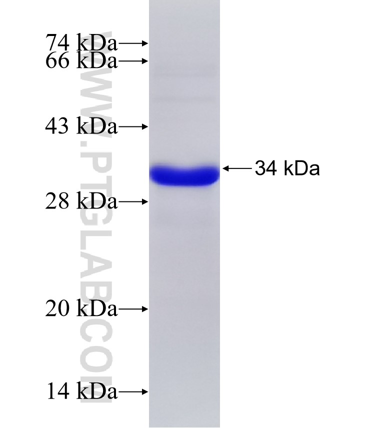 TSC1 fusion protein Ag31637 SDS-PAGE