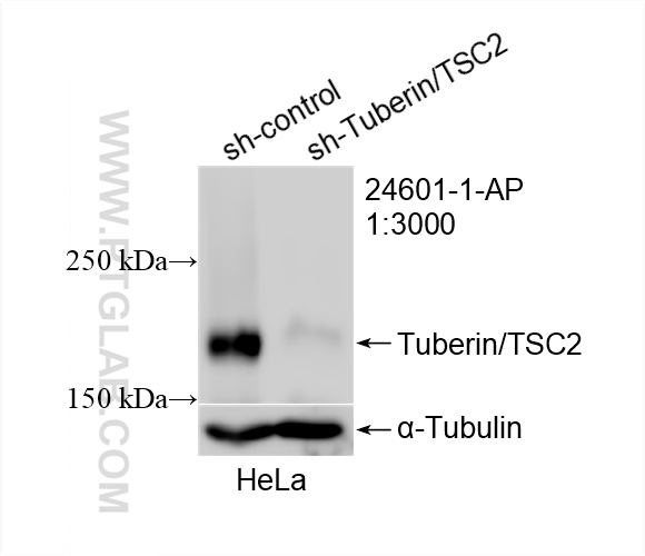 WB analysis of HeLa using 24601-1-AP