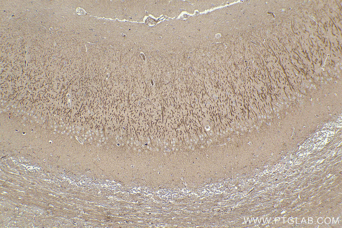 IHC staining of rat brain using 68380-1-Ig (same clone as 68380-1-PBS)