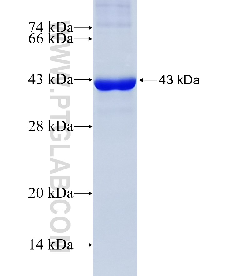 TSC2 fusion protein Ag19402 SDS-PAGE