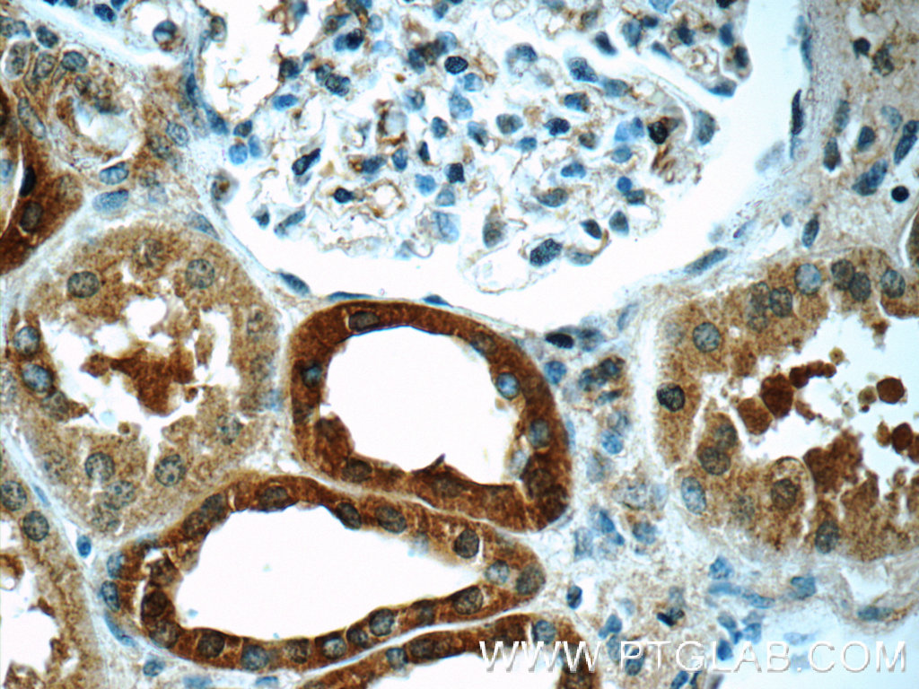 IHC staining of human kidney using 25418-1-AP