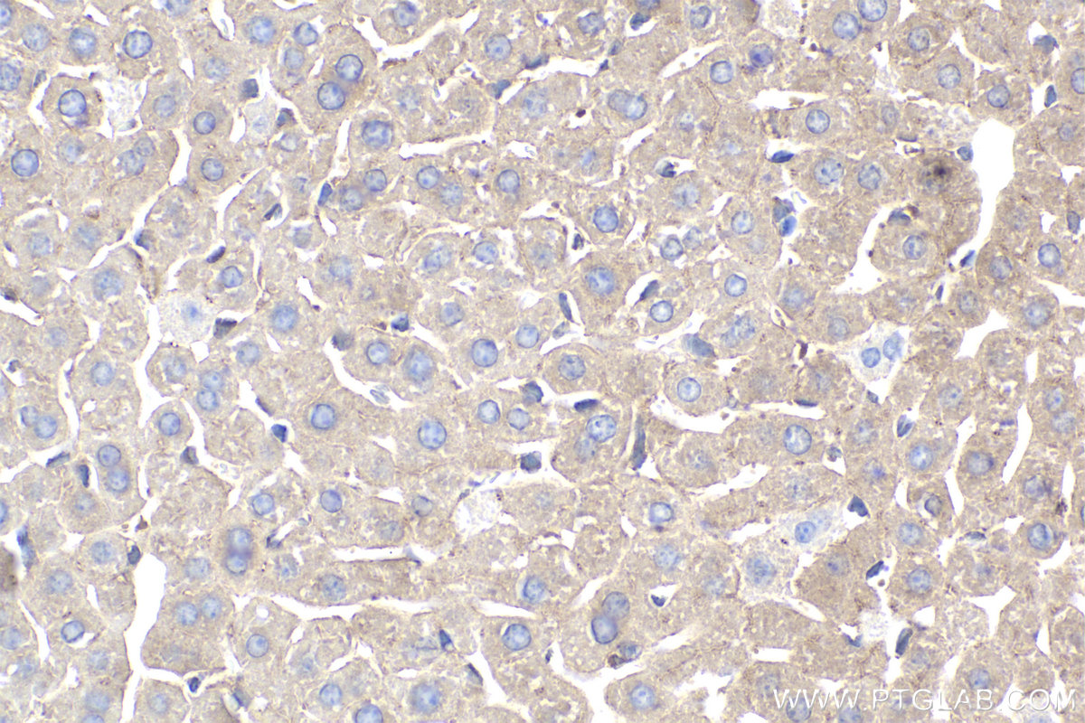 IHC staining of mouse liver using 12352-1-AP