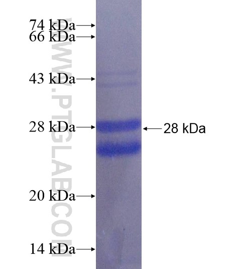 TSEN15 fusion protein Ag22082 SDS-PAGE