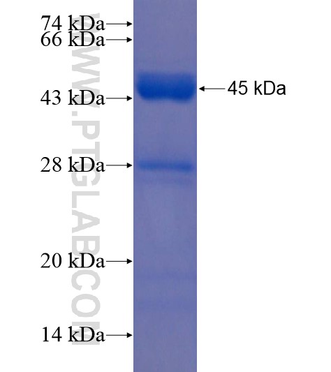 TSEN15 fusion protein Ag22156 SDS-PAGE