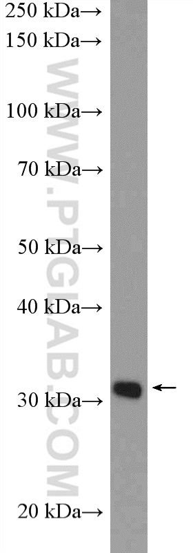 WB analysis of HeLa using 11701-1-AP