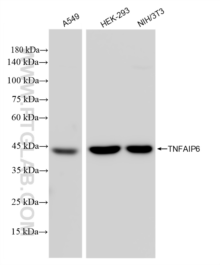 WB analysis using 83163-4-RR (same clone as 83163-4-PBS)