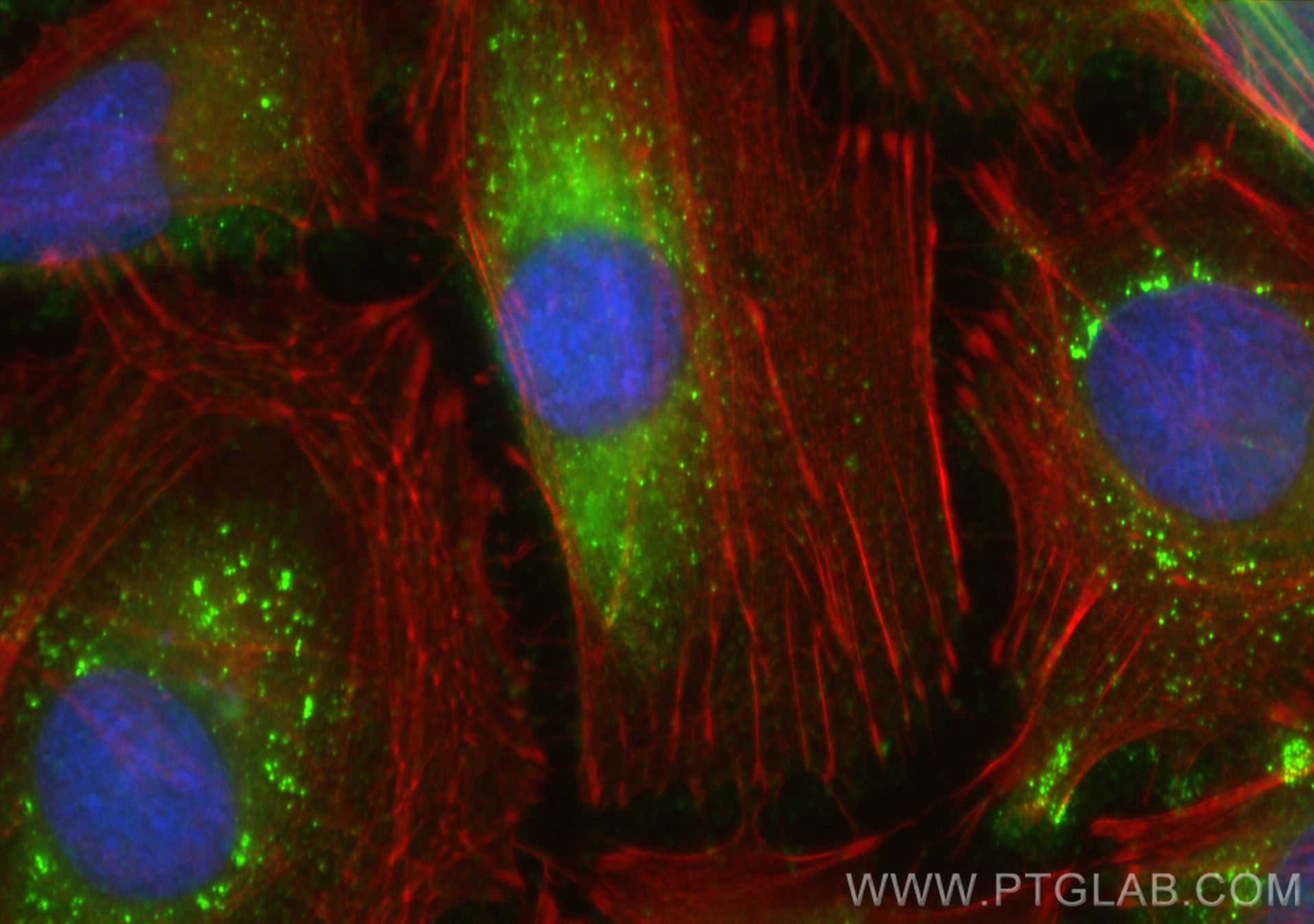 IF Staining of HeLa using 28283-1-AP