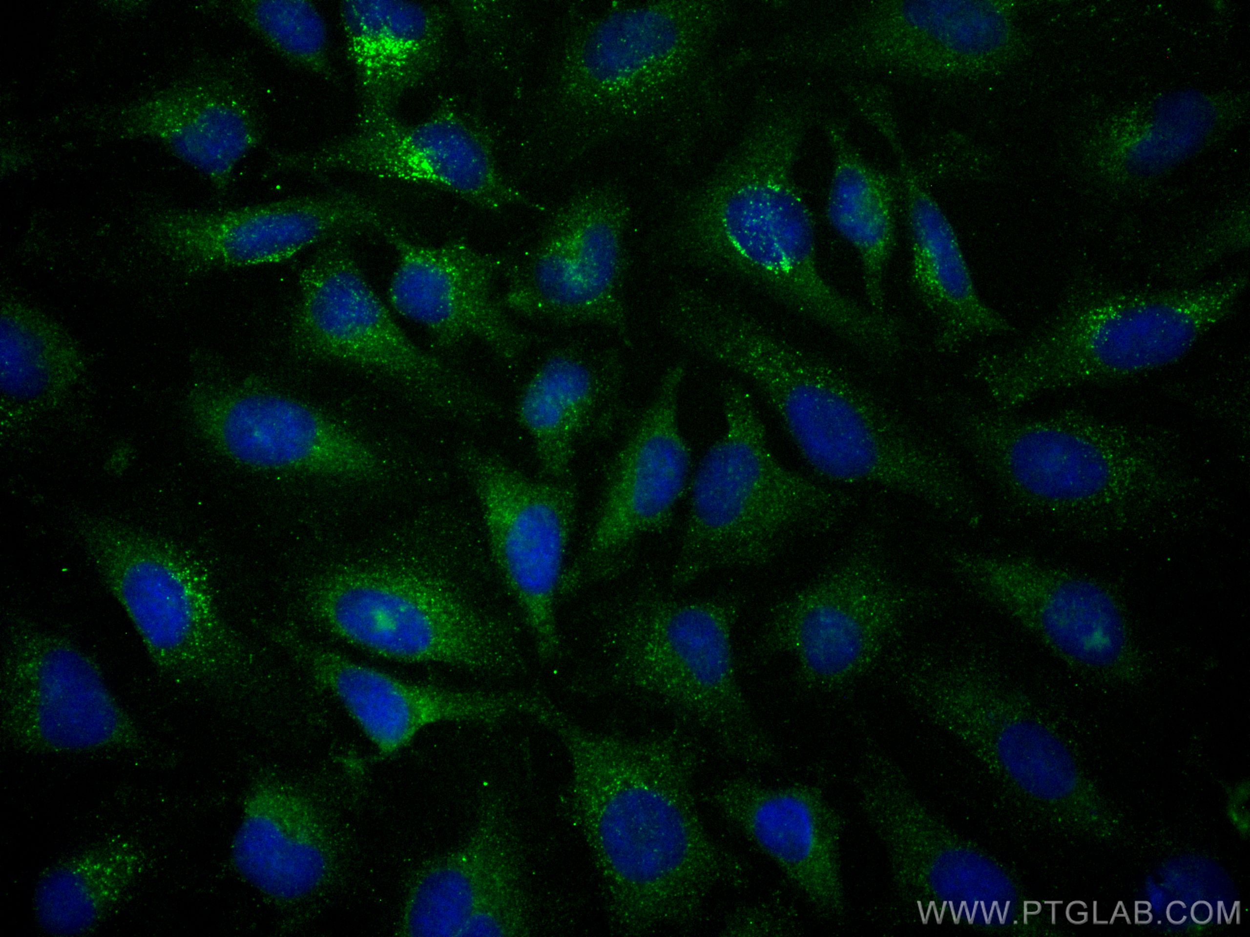 IF Staining of HeLa using FITC-67381