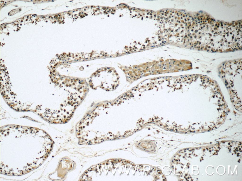 IHC staining of human testis using 17566-1-AP