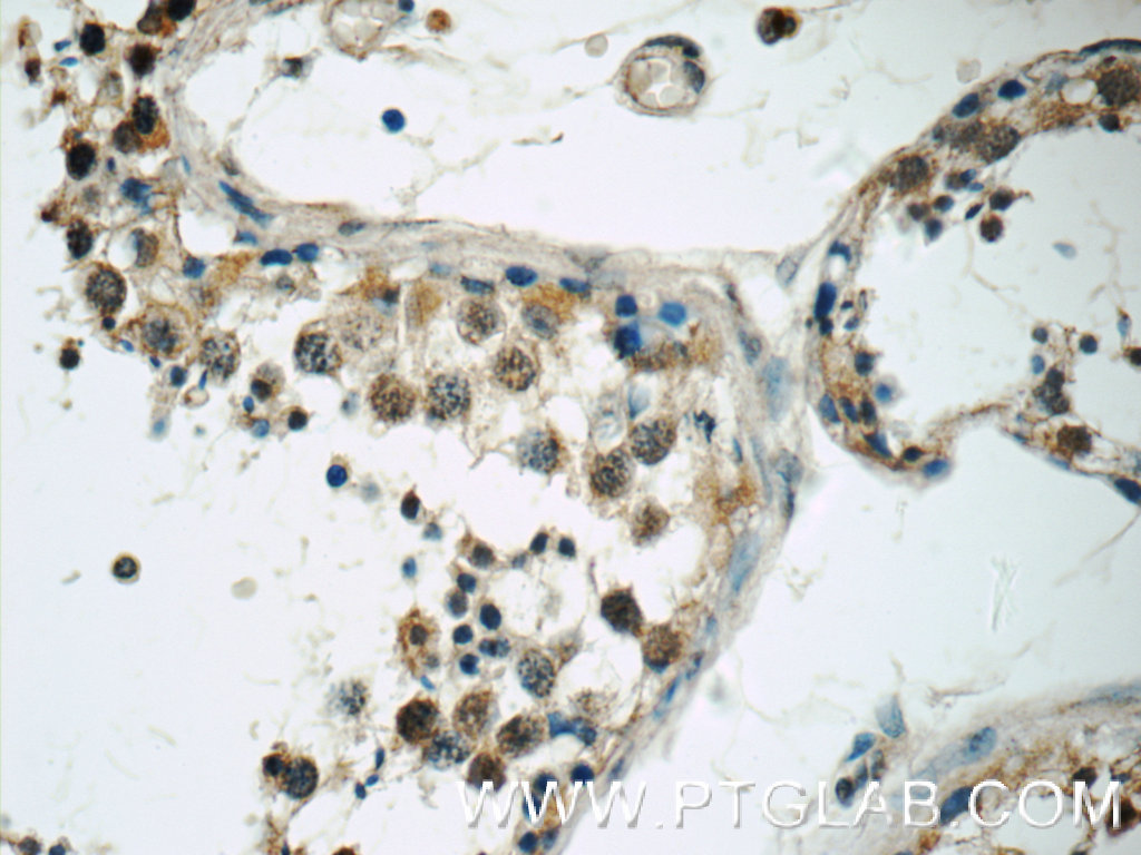 IHC staining of human testis using 17566-1-AP