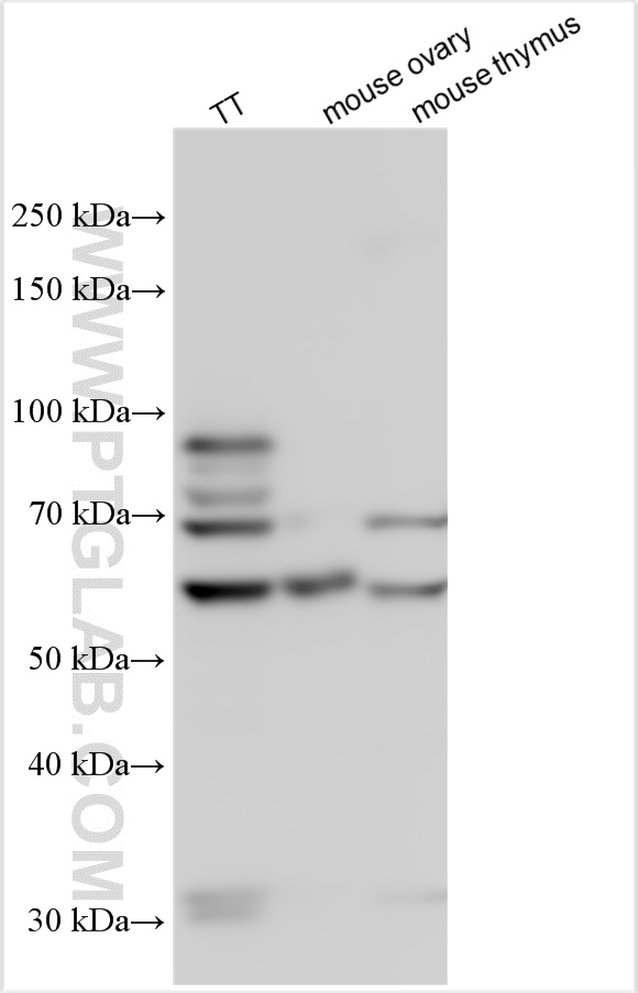 WB analysis using 14450-1-AP