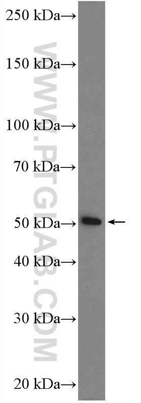 WB analysis of mouse liver using 12370-1-AP