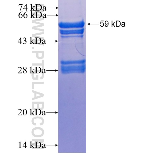 TSNAX fusion protein Ag1507 SDS-PAGE