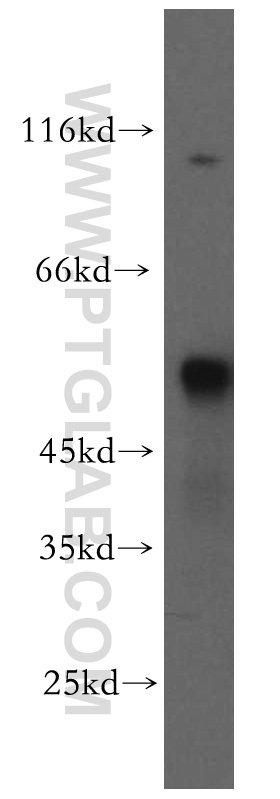 WB analysis of MCF-7 using 12574-1-AP