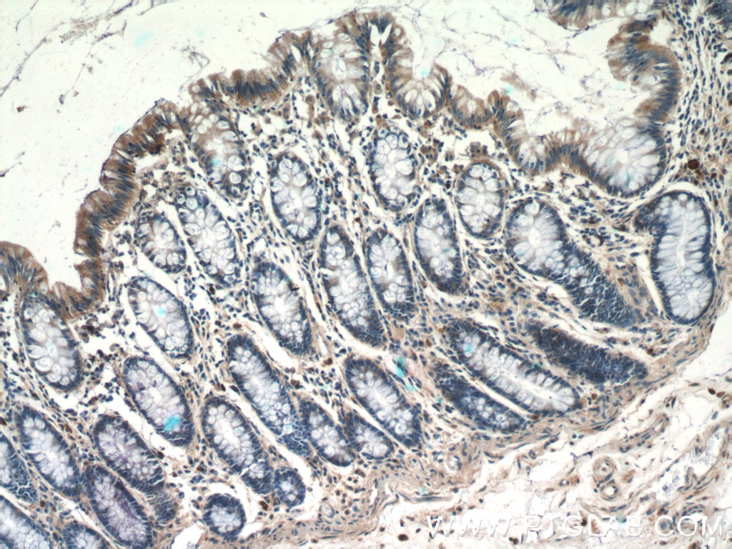 IHC staining of human colon using 16058-1-AP