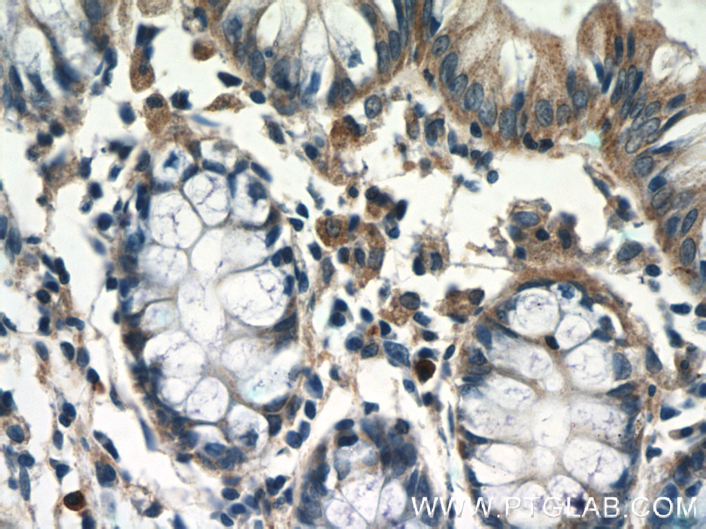 IHC staining of human colon using 16058-1-AP