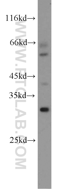 WB analysis of mouse lung using 18974-1-AP