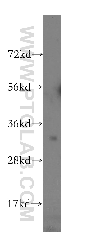 WB analysis of human ovary cancer using 10460-1-AP