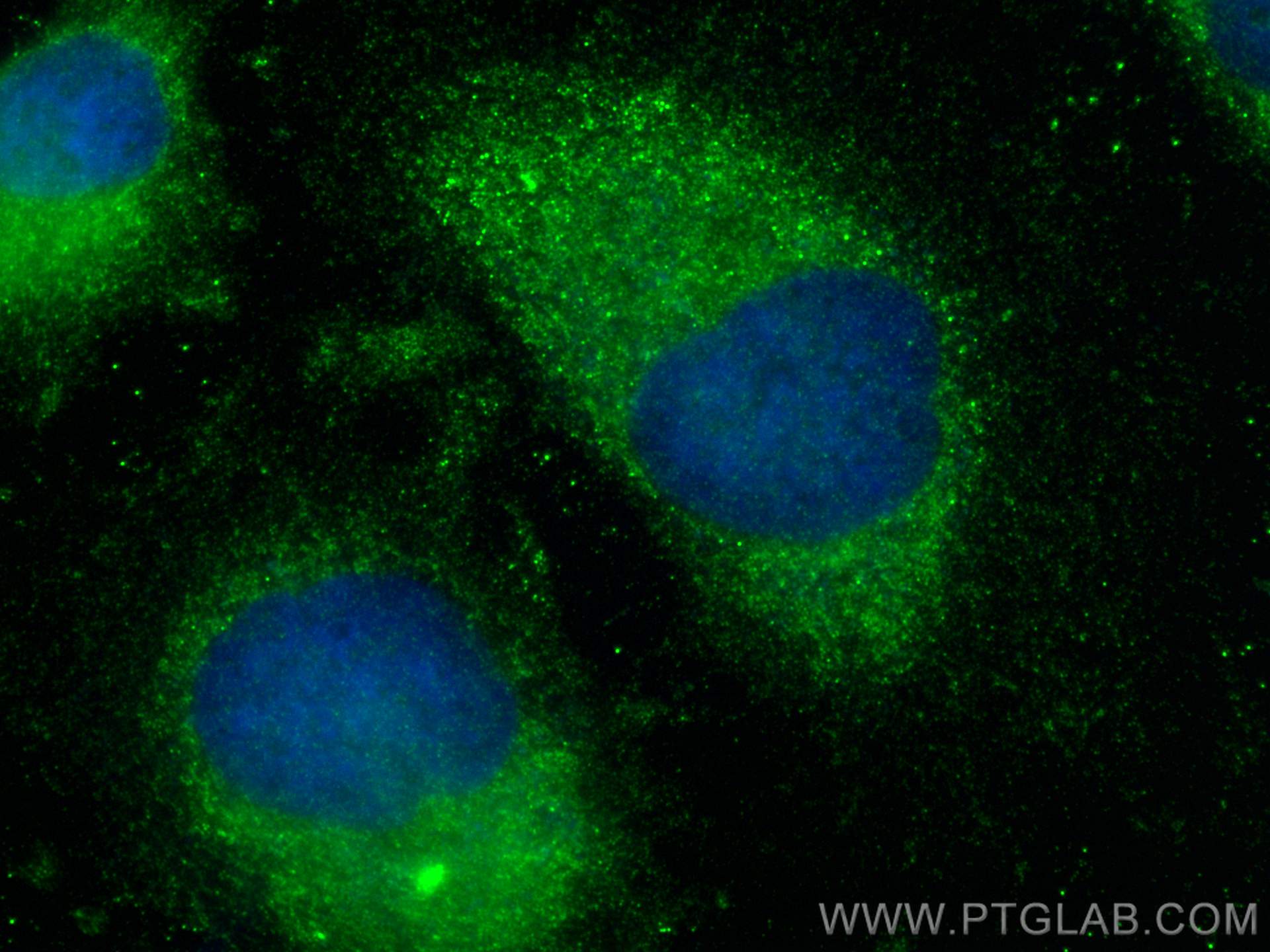 IF Staining of HeLa using 13036-1-AP