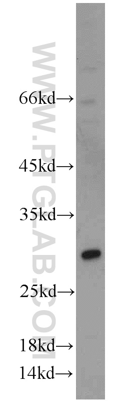 WB analysis of HeLa using 21987-1-AP