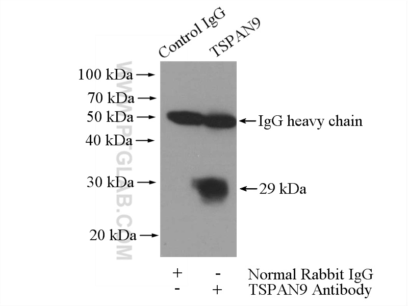 IP experiment of mouse spleen using 21983-1-AP