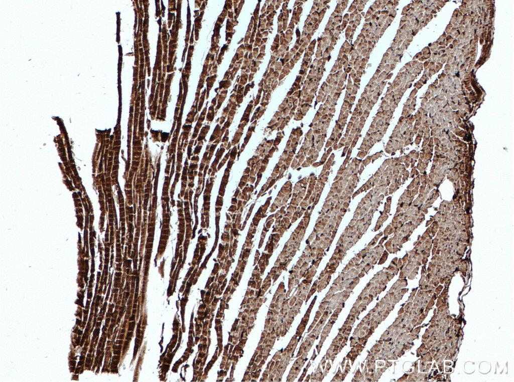 IHC staining of mouse heart using 15444-1-AP