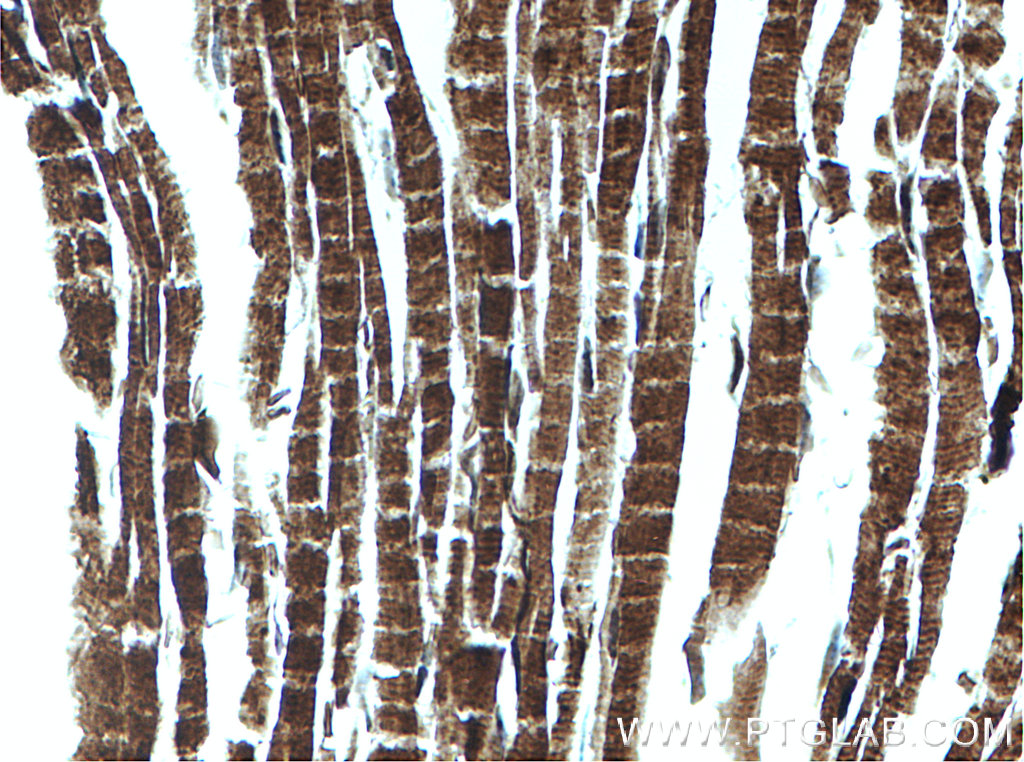 IHC staining of mouse heart using 15444-1-AP
