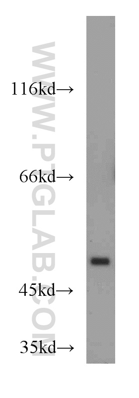 WB analysis of mouse lung using 13932-1-AP