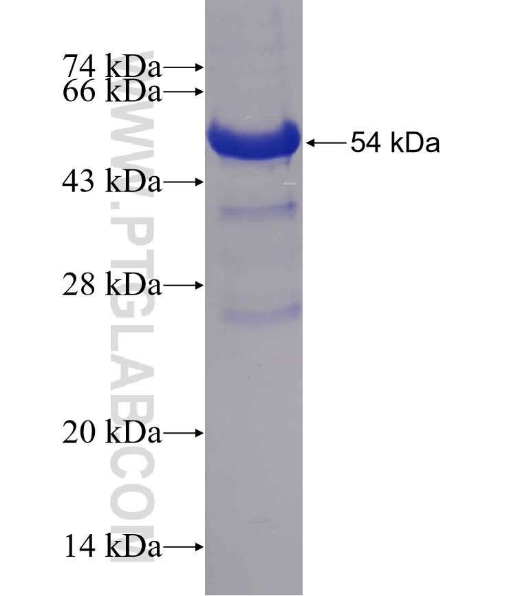 TSPYL1 fusion protein Ag5285 SDS-PAGE