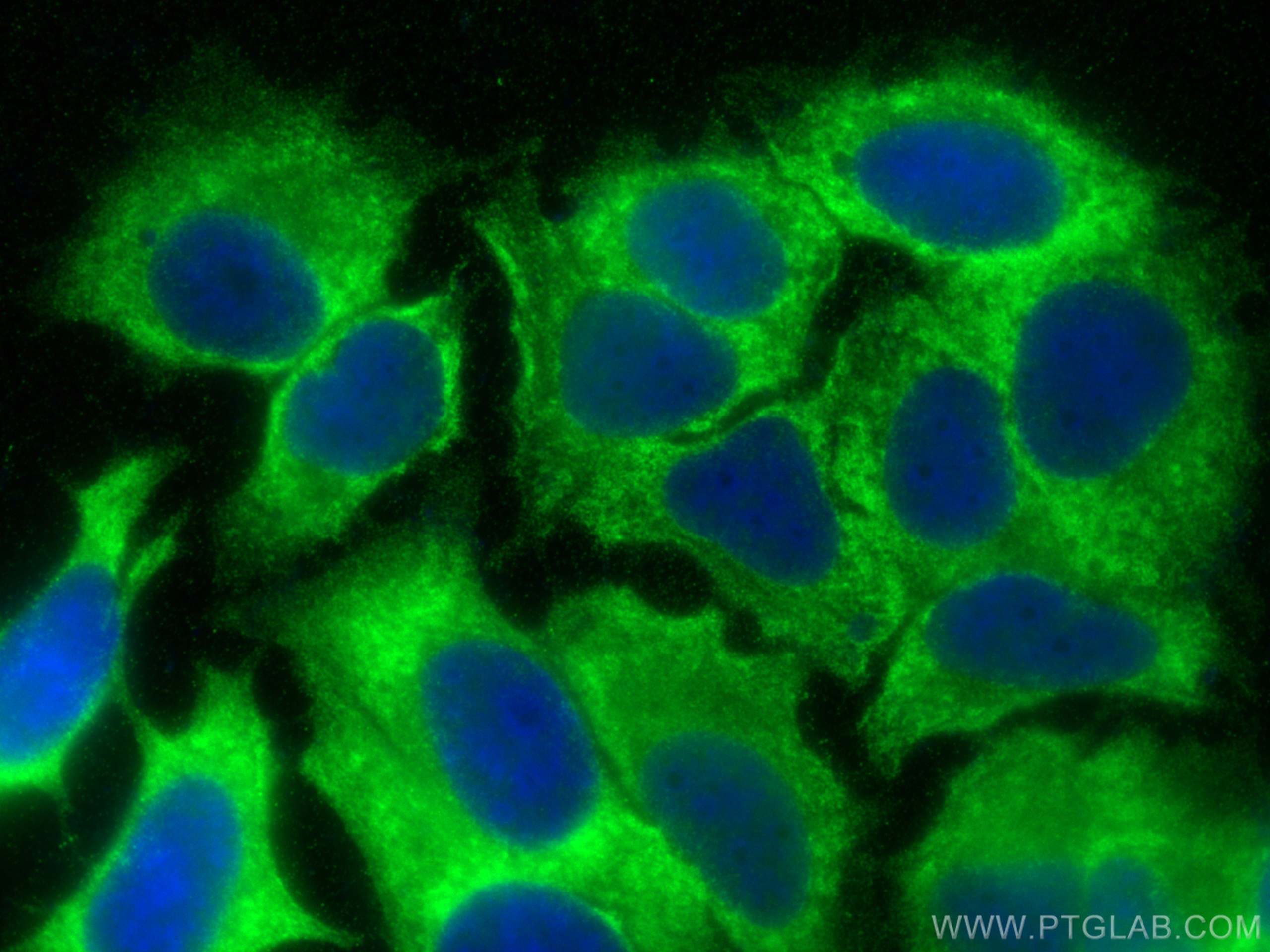 IF Staining of MCF-7 using 16263-1-AP