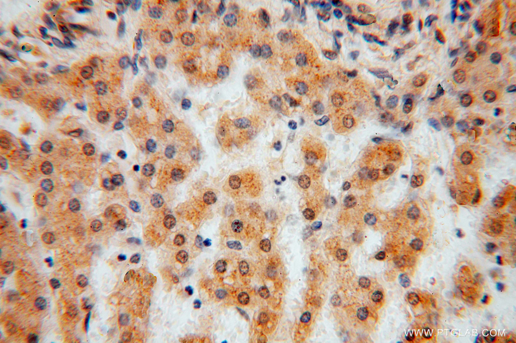 IHC staining of human liver using 16263-1-AP