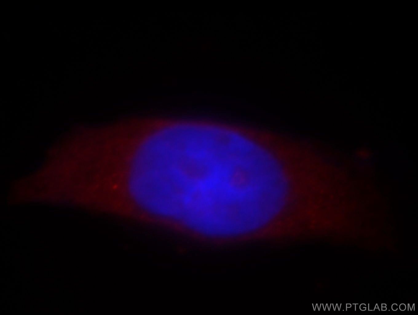 IF Staining of HeLa using 14531-1-AP