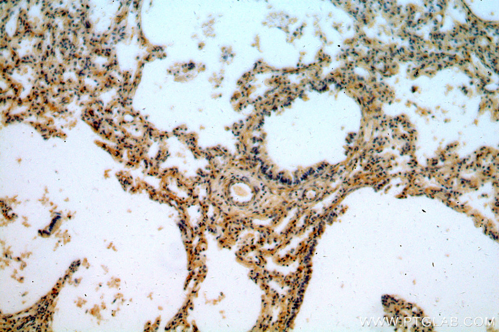 IHC staining of human lung using 14531-1-AP