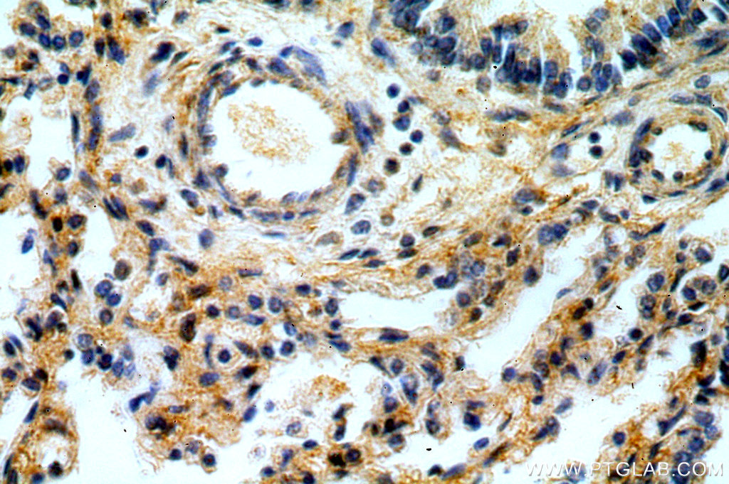 IHC staining of human lung using 14531-1-AP