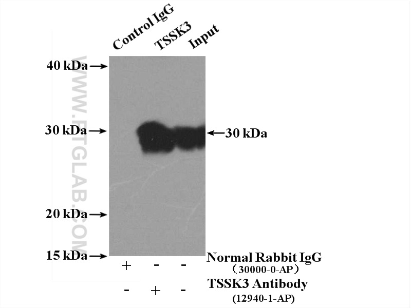 IP experiment of mouse testis using 12940-1-AP