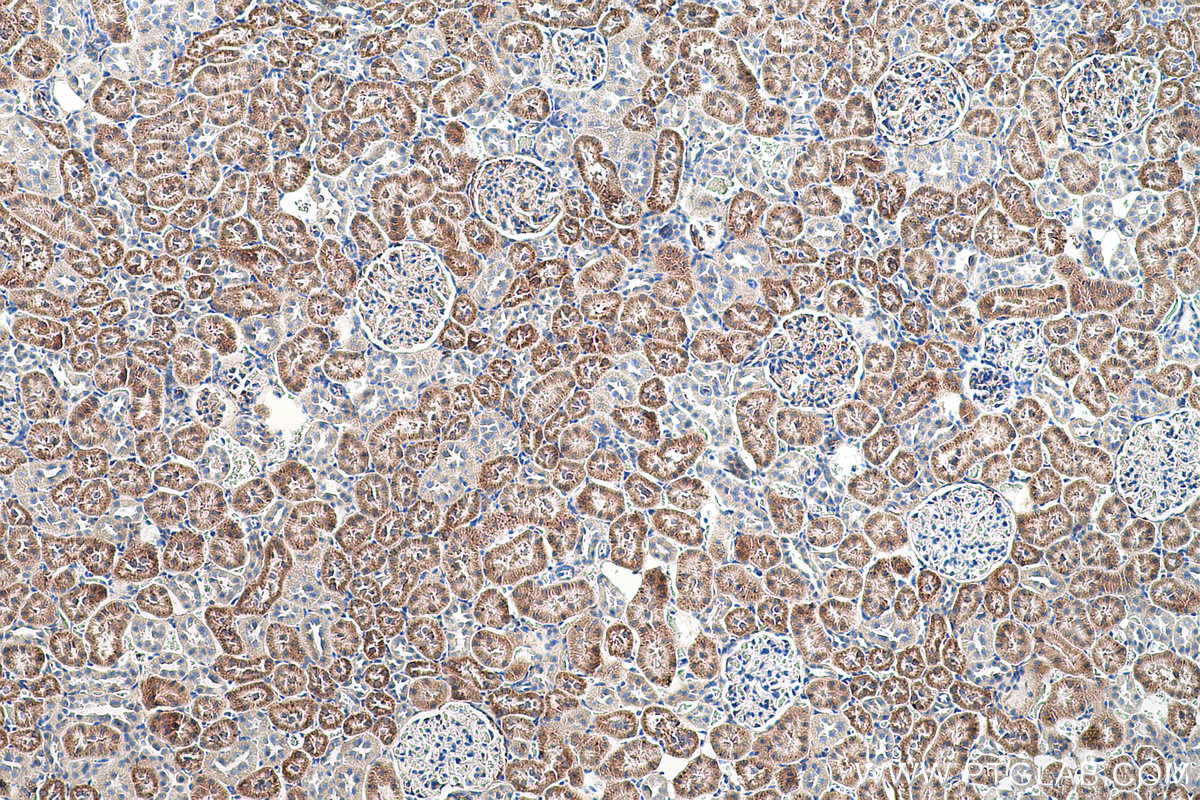 IHC staining of rat kidney using 66018-1-Ig