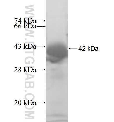 TSTA3 fusion protein Ag7473 SDS-PAGE