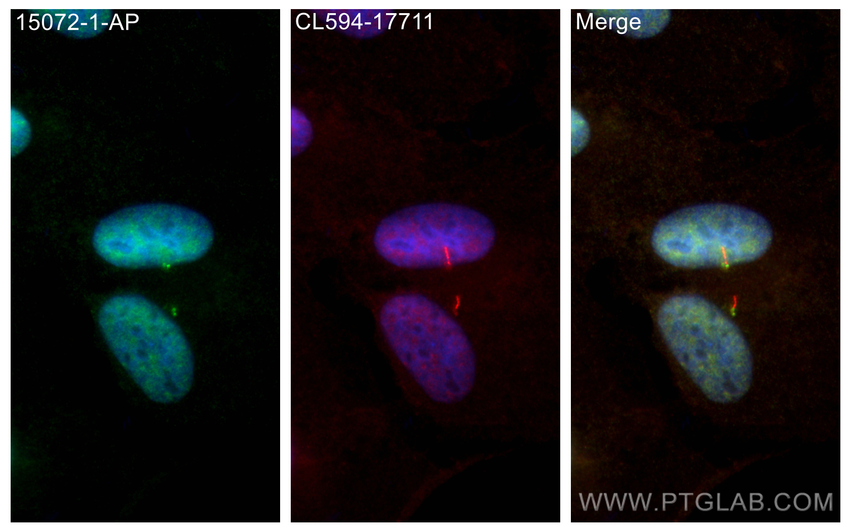 IF Staining of hTERT-RPE1 using 15072-1-AP