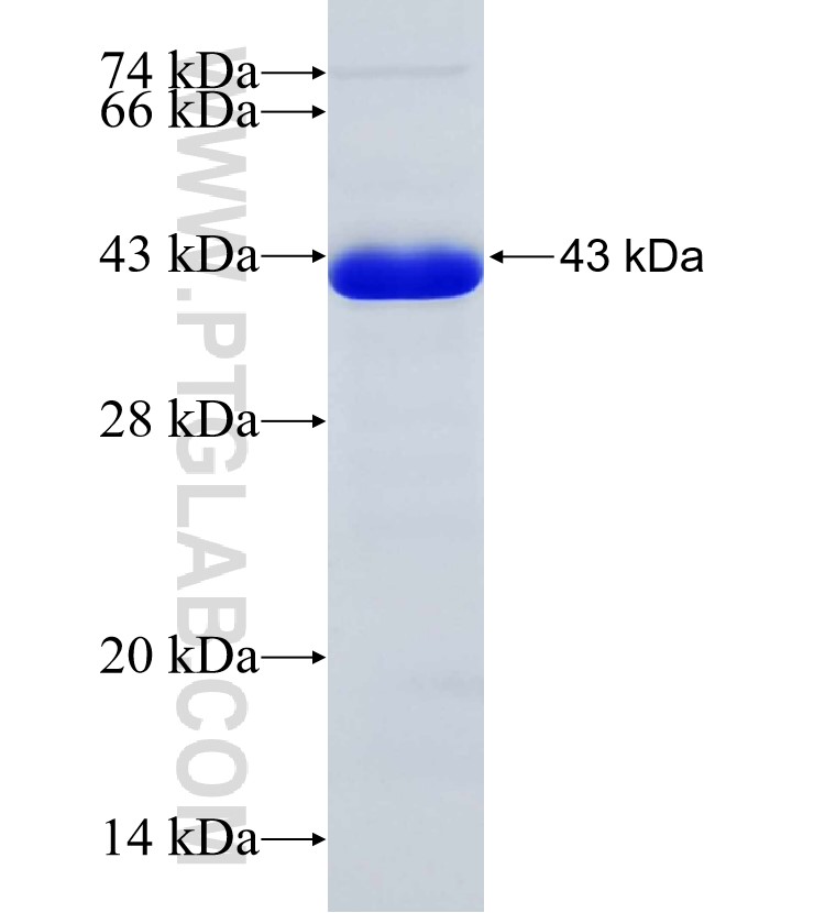 TTBK2 fusion protein Ag30470 SDS-PAGE