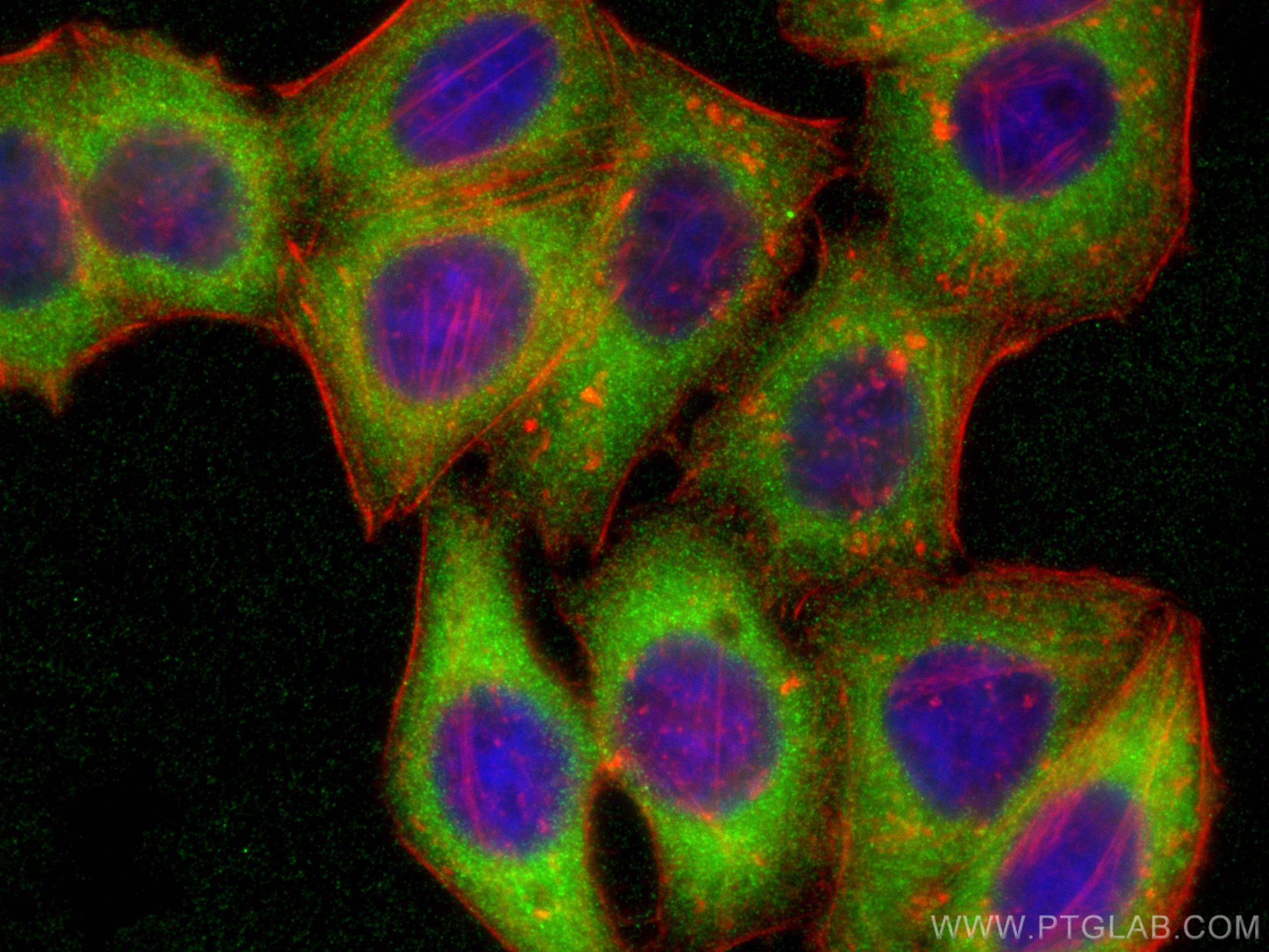 IF Staining of HepG2 using 11676-1-AP