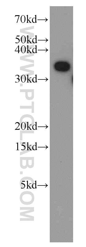 WB analysis of HEK-293 using 11676-1-AP