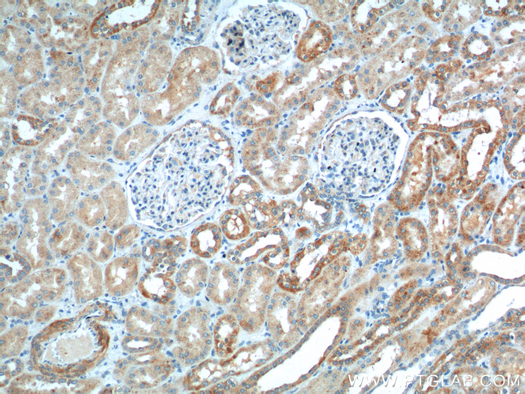 IHC staining of human kidney using 25660-1-AP