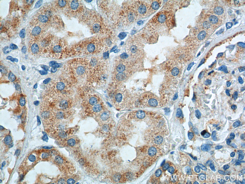 IHC staining of human kidney using 25660-1-AP