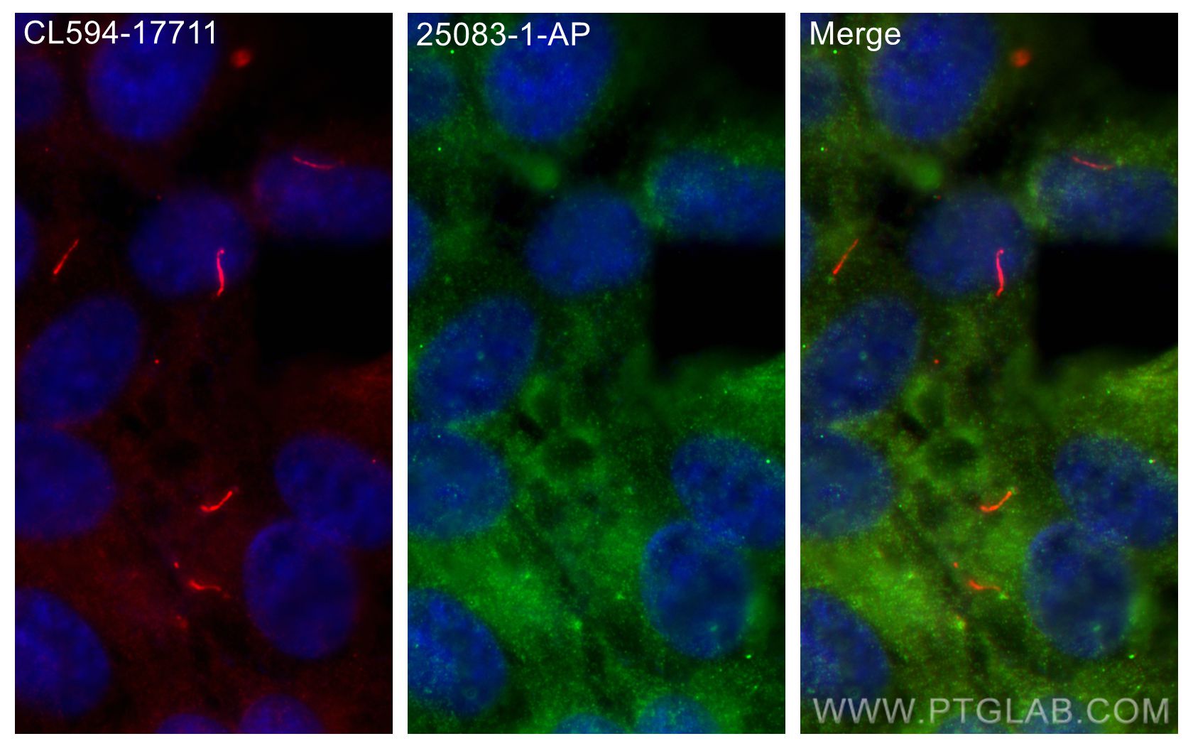 IF Staining of hTERT-RPE1 using 25083-1-AP