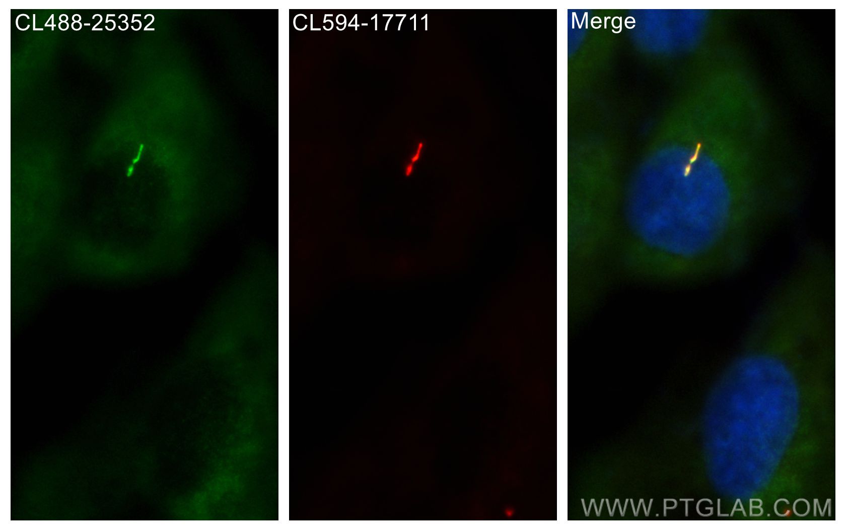 IF Staining of hTERT-RPE1 using CL488-25352