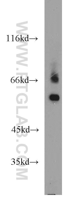 WB analysis of mouse testis using 23432-1-AP